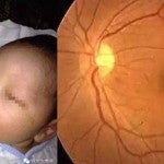 ¿Es real la historia del bebé que quedó ciego tras tomarle una foto con flash