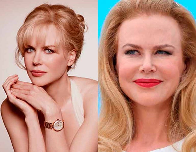 El nuevo rostro de Nicole Kidman