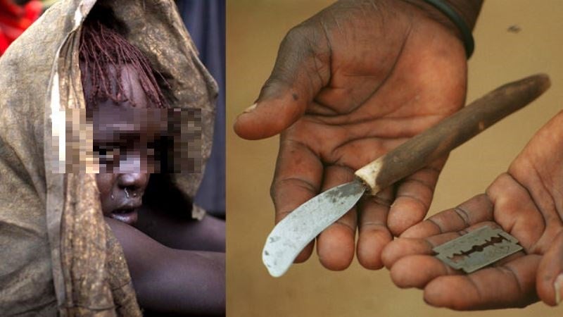 mutilación genital