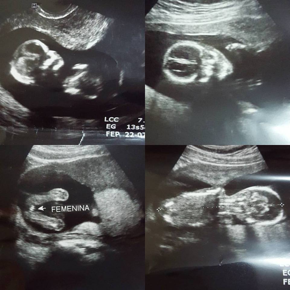 Imágenes de la bebé dentro de la joven