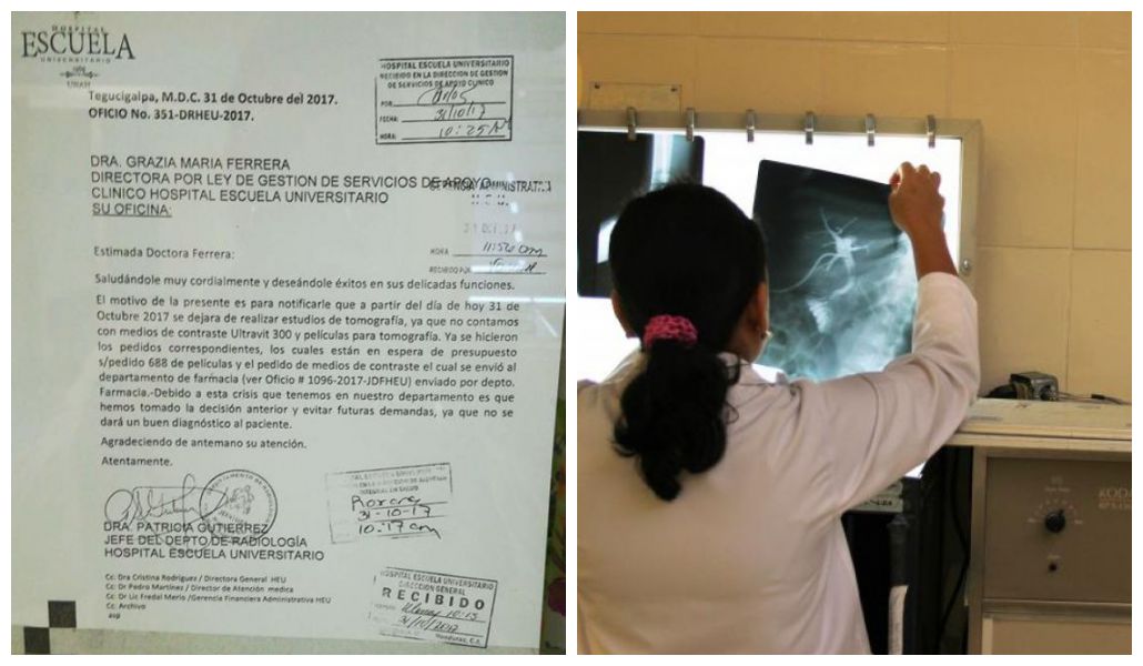 suspenden tomografías en el Hospital Escuela