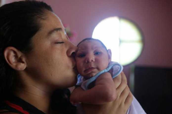 Dos bebés con microcefalia se reportan en este 2018