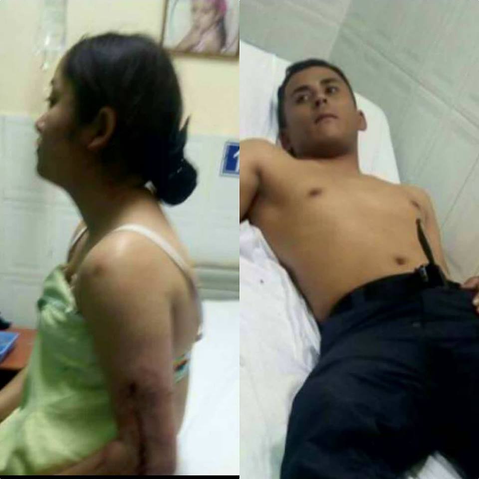 cuatro heridos en comayagua