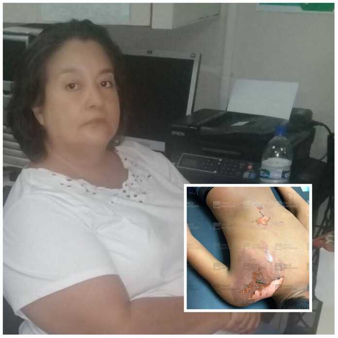 Señora quema a niño en San Pedro Sula