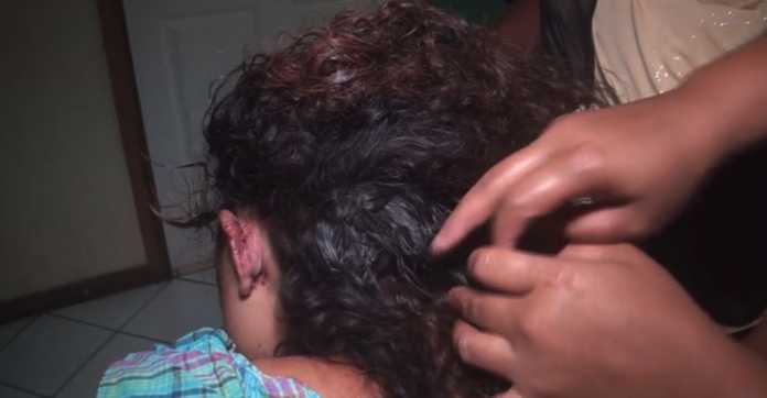 Mujer golpeada en Olanchito