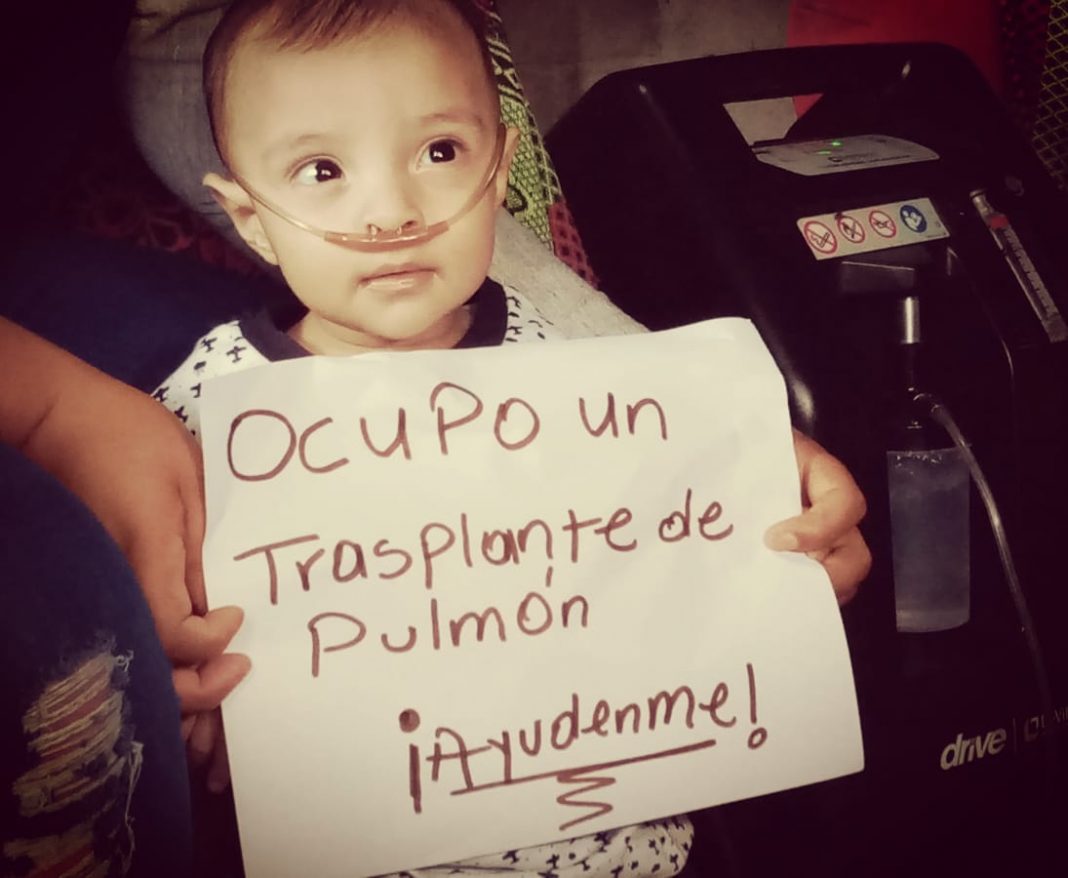 niño que necesita trasplante de pulmón en Honduras