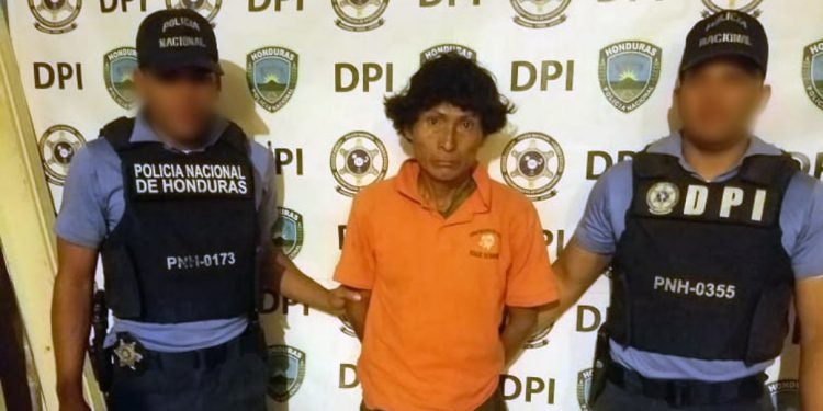Honduras: cae hombre por castigar a su hijo quemándole un brazo