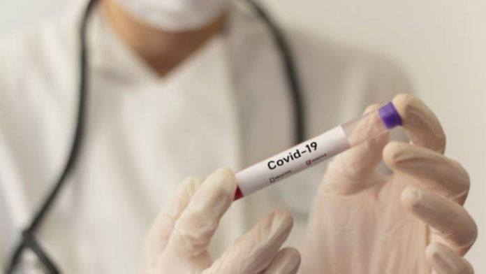 coronavirus-prueba-1