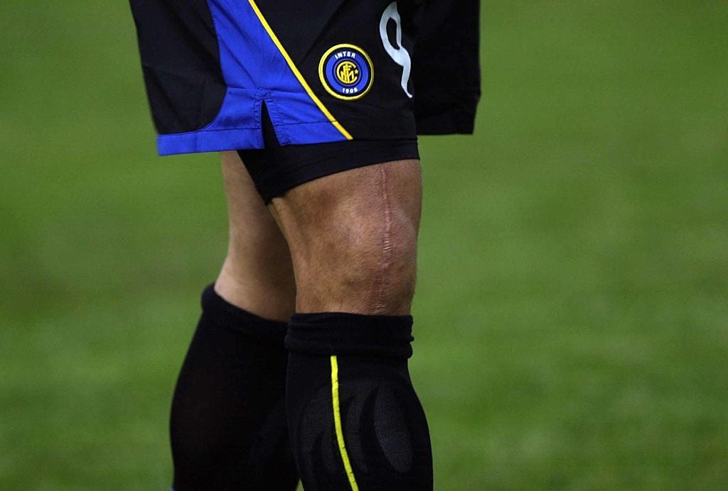 Se cumplen 20 años de la lesión que marcó la carrera de Ronaldo