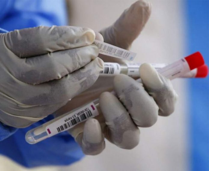 pruebas PCR pruebas PCR