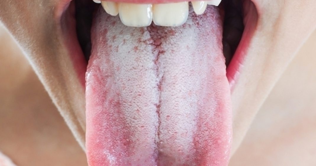lengua blanca