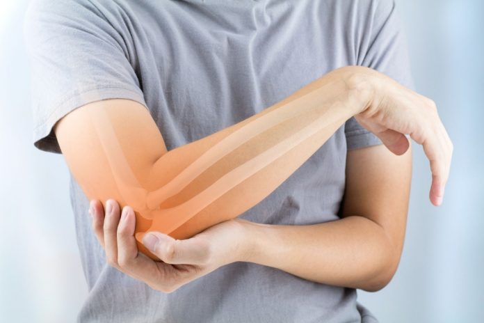 osteoporosis osteoporosis