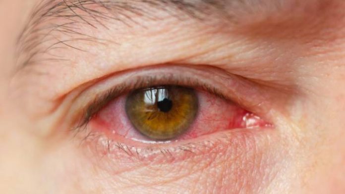 detectan covid en ojos detectan covid en ojos