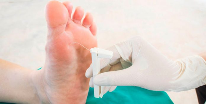 Tipos de neuropatía diabética Tipos de neuropatía diabética