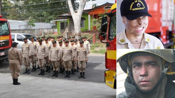 Día Del Bombero En Honduras: 65 Años De Una Labor Heroica Y Humana