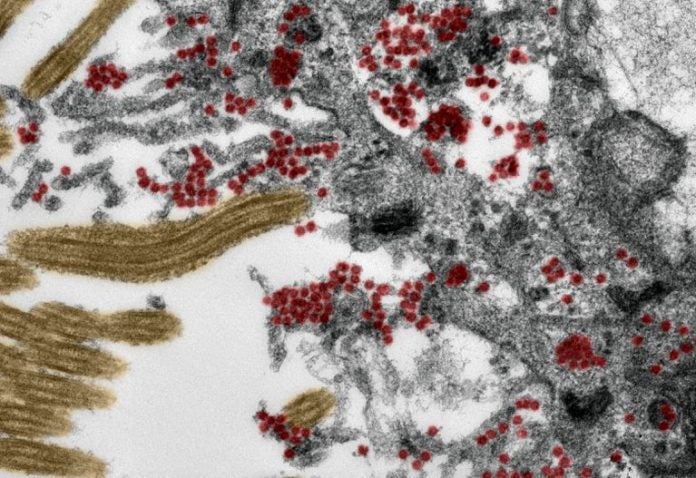 CEPA DEL CORONAVIRUS CEPA DEL CORONAVIRUS