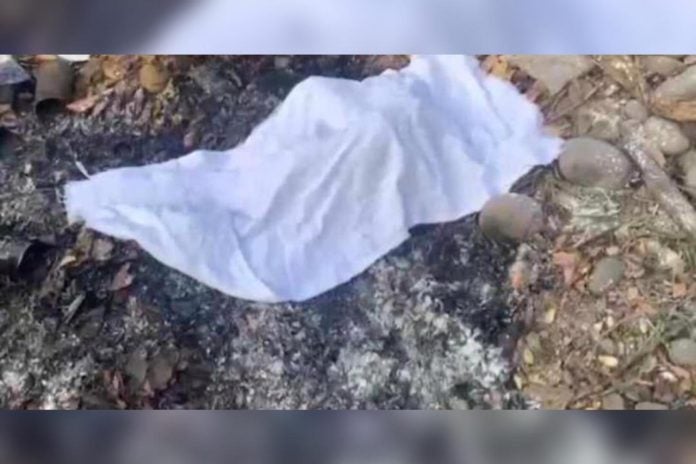 bebé calcinado en Choluteca bebé calcinado en Choluteca