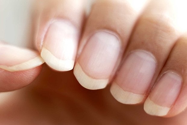 Understanding the Color of Your Nails and What It Means for Your Health - wide 1