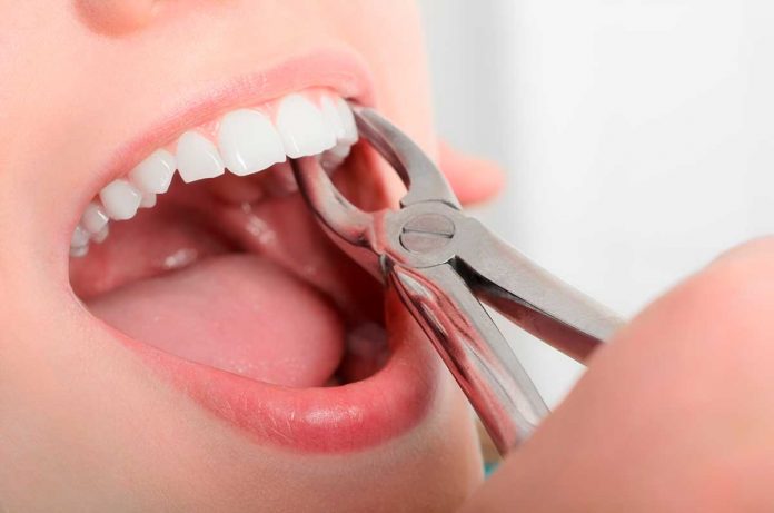 cuidados extracción dental cuidados extracción dental
