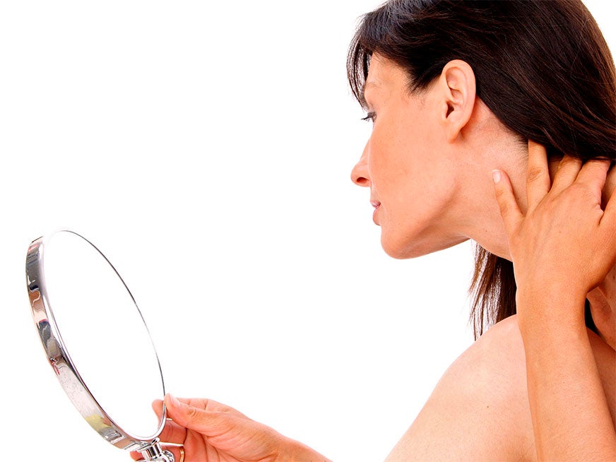acné y tiroides relación