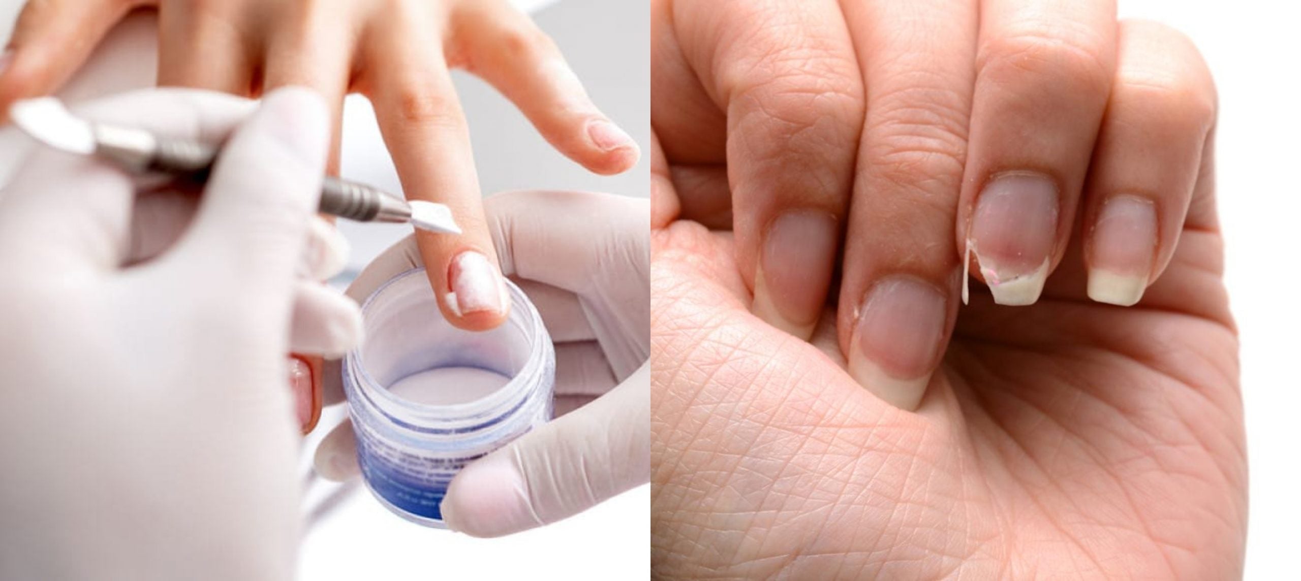Efectos secundarios al aplicar excesivo acrílico en las uñas