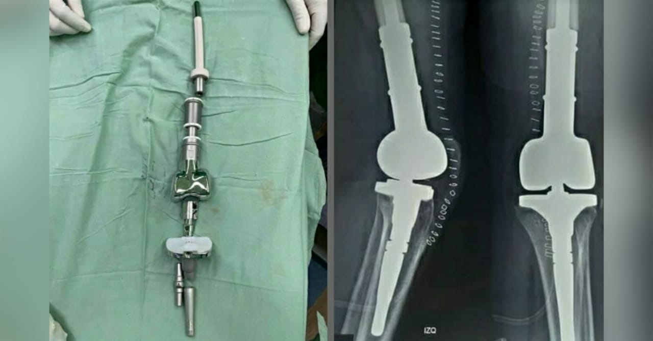 reemplazo de rodilla en Hospital Escuela