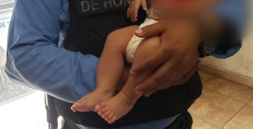 bebé golpeado por su madre SPS