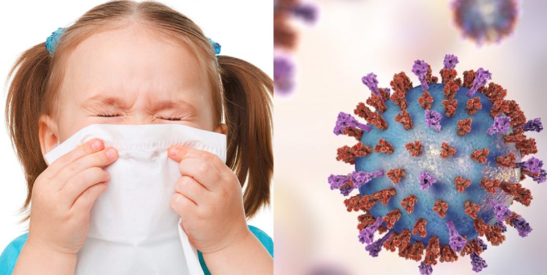 Virus Sincitial Respiratorio en menores