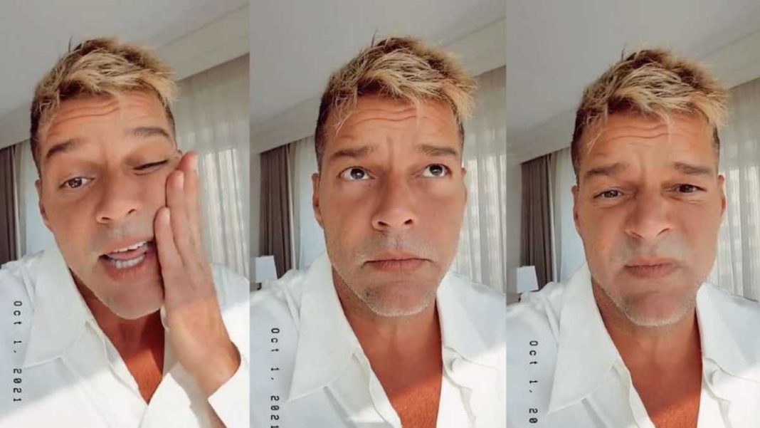 Ricky Martin rostro