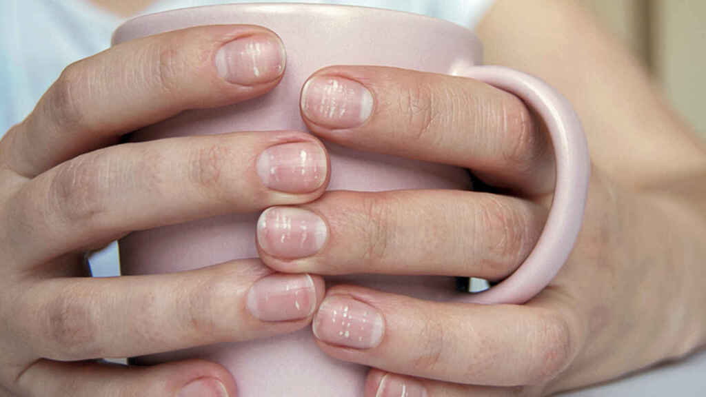 qué dicen las uñas sobre la salud