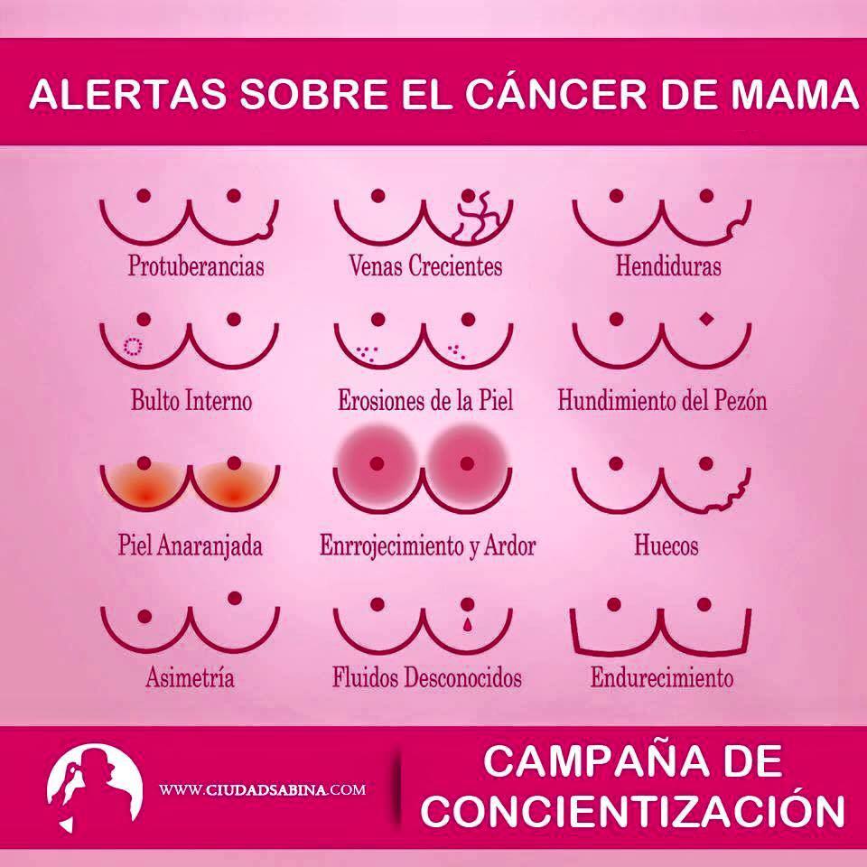 Para detectar a tiempo el cáncer de mama, las mujeres deben evaluarse constantemente y palpar sus senos.