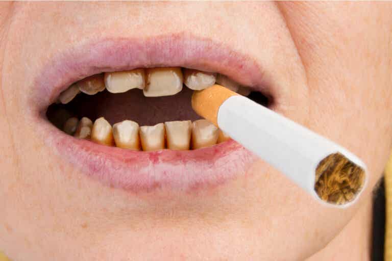 Tabaco y salud de la boca
