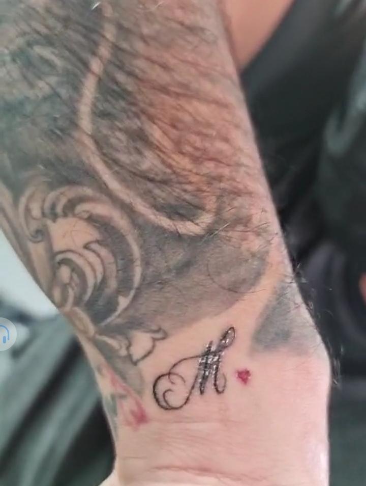 Milagro Flores borra tatuaje 