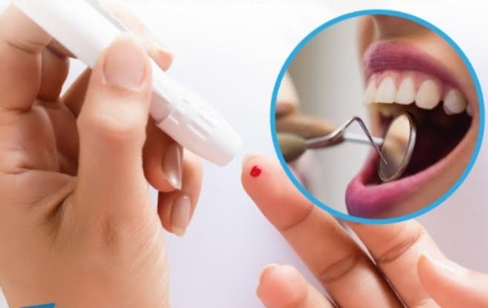 higiene bucal personas diabetes