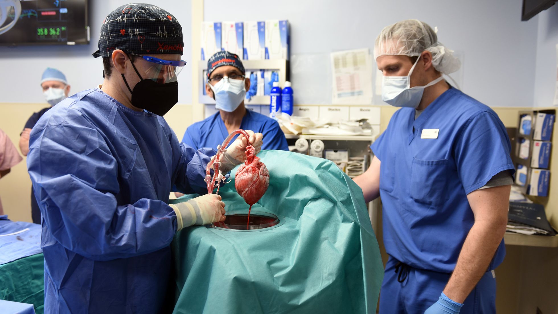 El trasplante de corazón de cerdo abre un universo de probabilidades para miles de pacientes que esperan un órgano.
