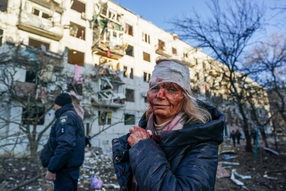 Una herida tras el ataque a un bloque de viviendas en la ciudad ucrania de Chuhuiv.