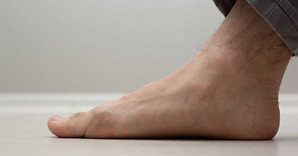 La corrección del pie plano con plantillas es prescrita por profesionales de la traumatología y la ortopedia. No pueden emplearse dispositivos no certificados.