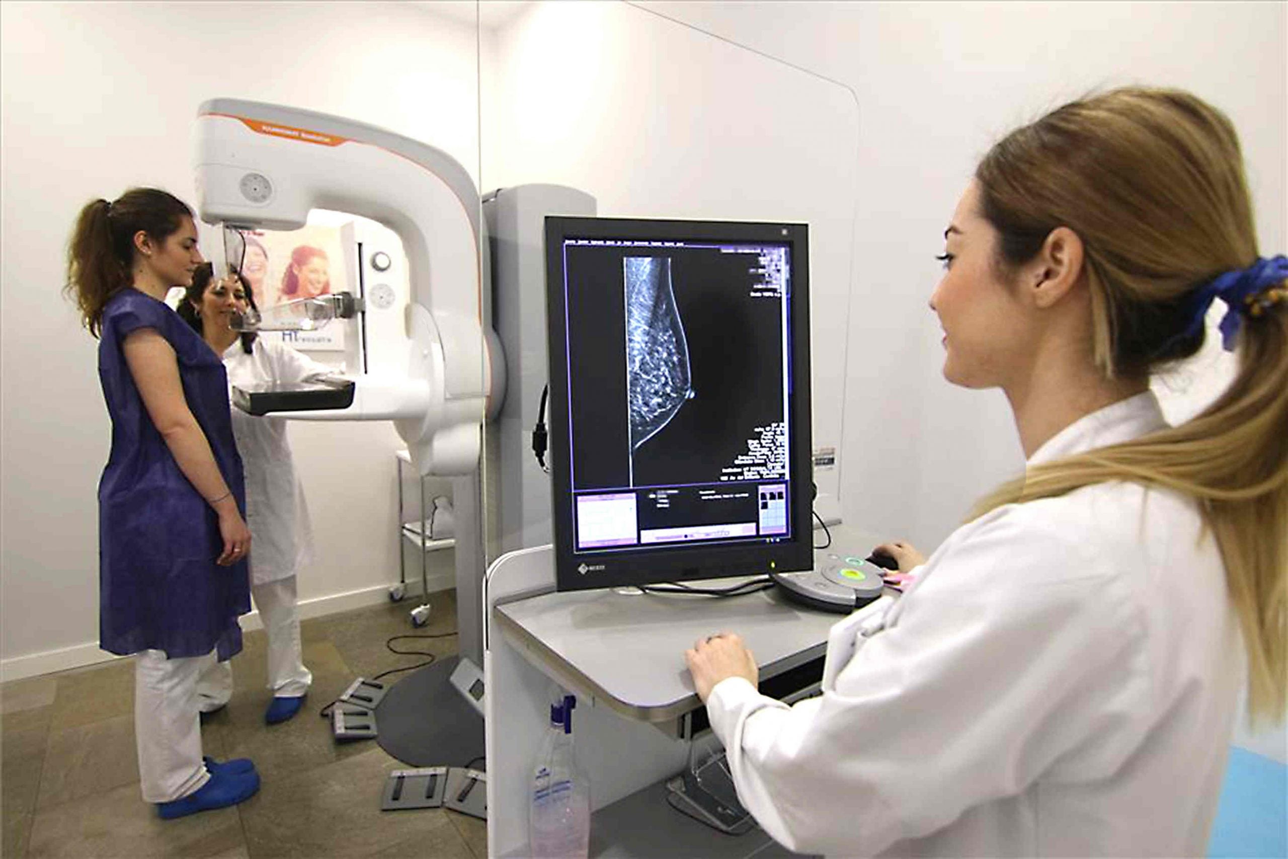 mamografía 