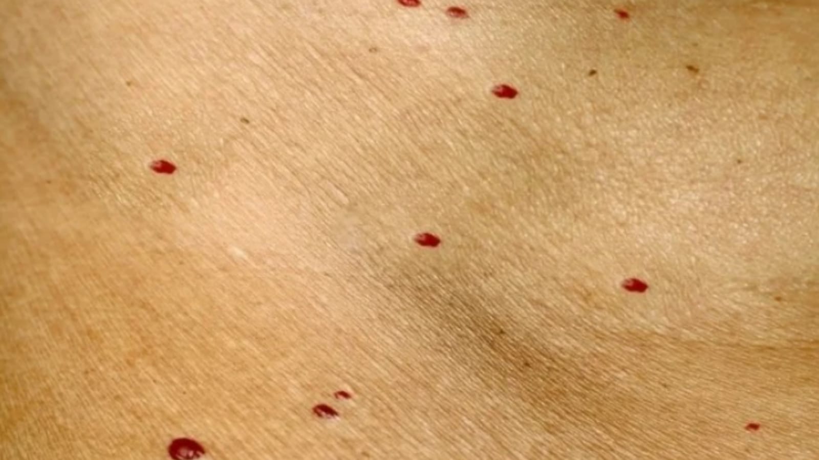 puntos rojos en la piel