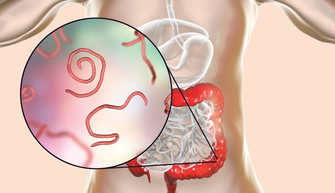 síntomas de parásitos en el intestino