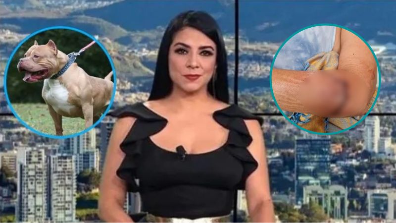 periodista atacada pitbull injerto en su brazo