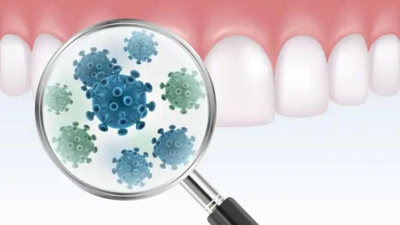 datos de placa bacteriana dental
