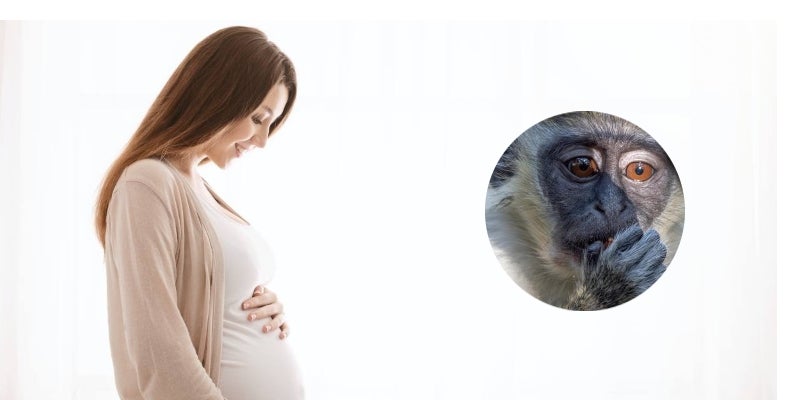 embarazada viruela del mono bebé