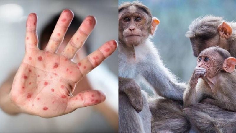 situaciones a evitar viruela del mono