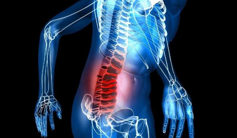 Una hernia discal se puede dar en cualquier porción de la columna vertebral. Por eso, hay hernia lumbar, cervical y torácica.