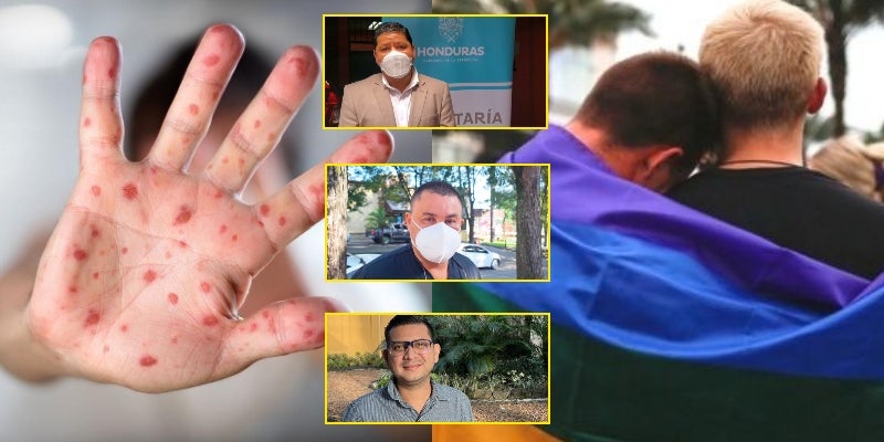 Honduras viruela del mono homofobia