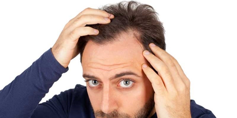 Muchas personas lucha contra la pérdida de cabellos con diferentes productos. 