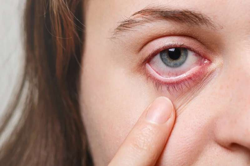 Hay hidratantes oculares para mantener el ojo en las condiciones adecuadas.