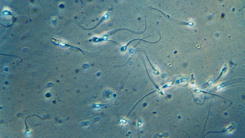 Estudios espermatozoides