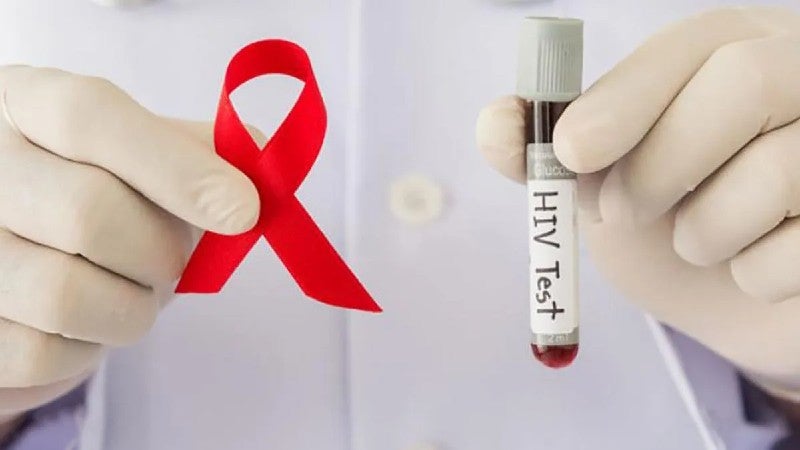 Día VIH Honduras